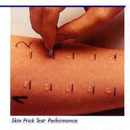 Test Solutions for Skin Prick Testing