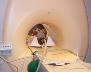 MRI - Magnetic Resonance Imaging 