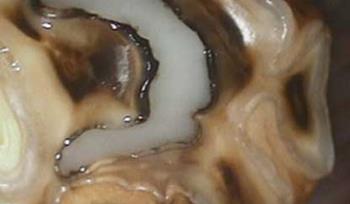 Equine Root Canals
