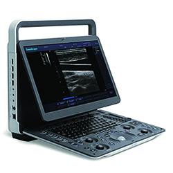 Portable Veterinary Ultrasound Equipment