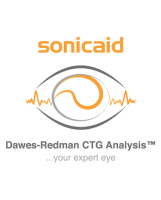 Sonicaid Dawes-Redman CTG Analysis
