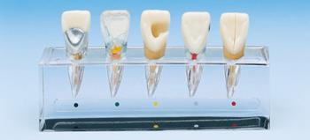 Supplier Of Endodontics Products