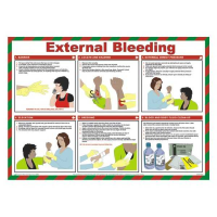 External Bleeding